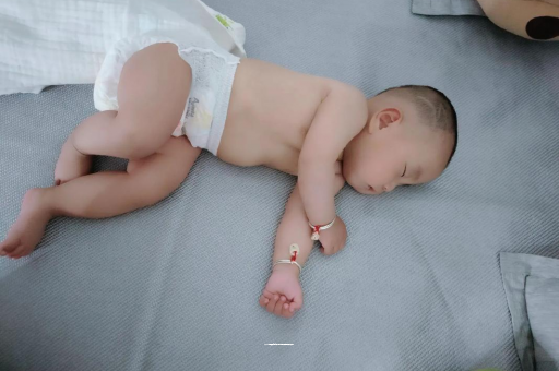 平邑宝宝头上长痱子 平邑宝宝头上长痱子